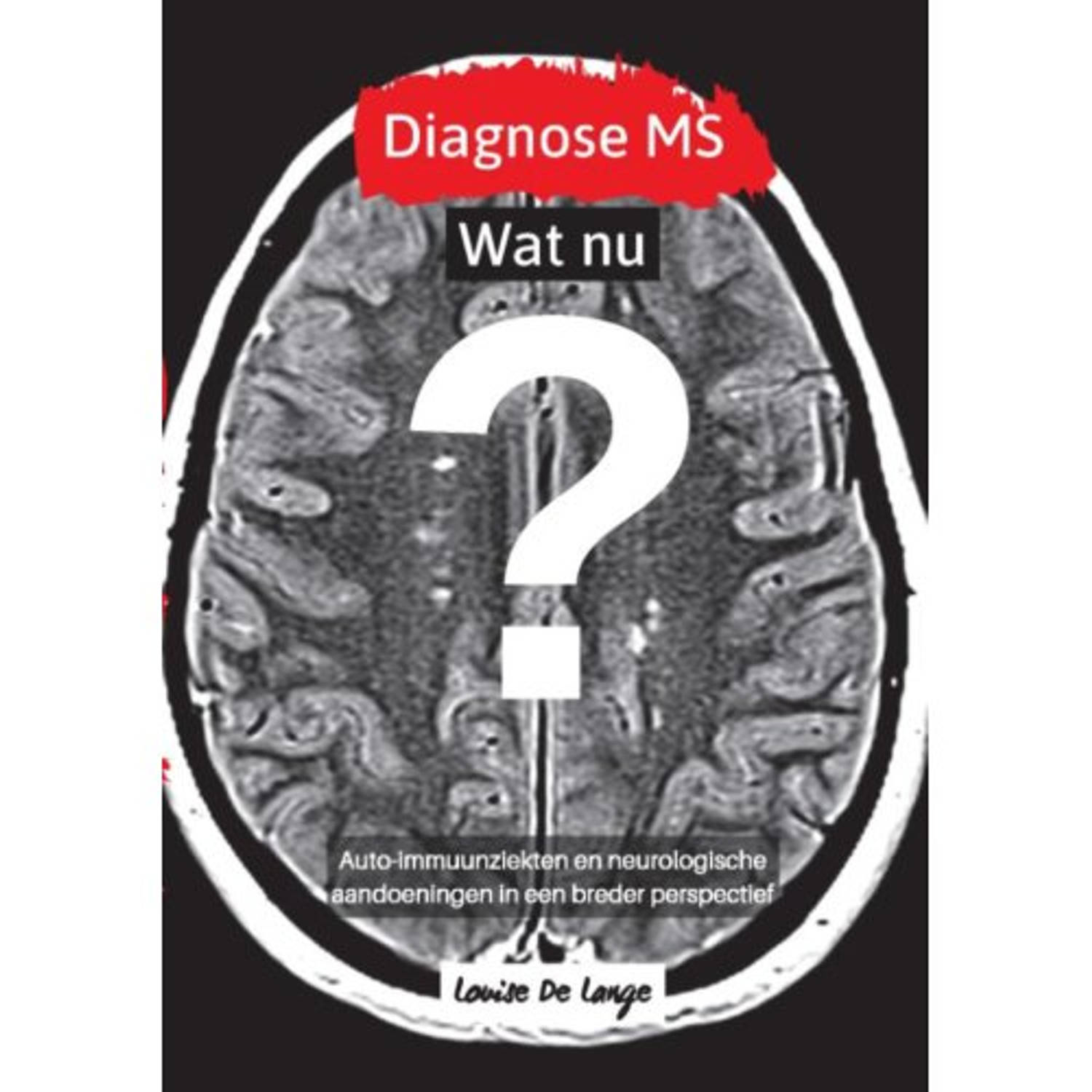 Diagnose Ms Wat Nu?